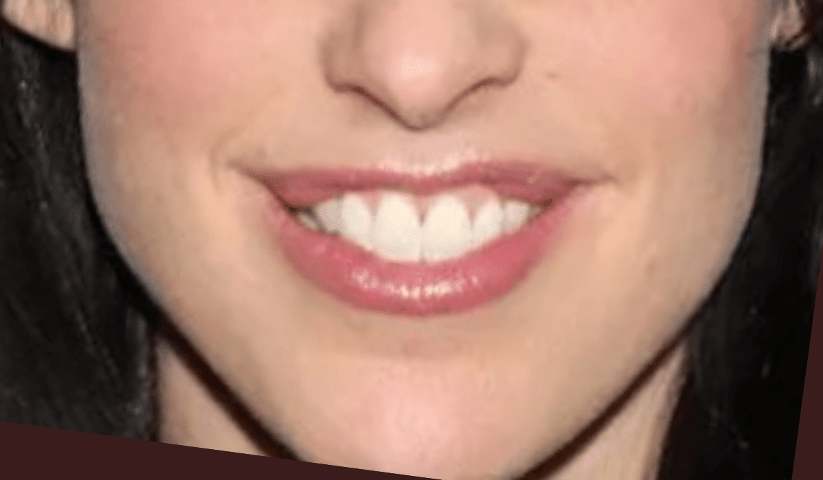 Catherine Reitman Lips