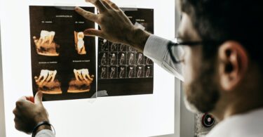 man looking at teeth x rays