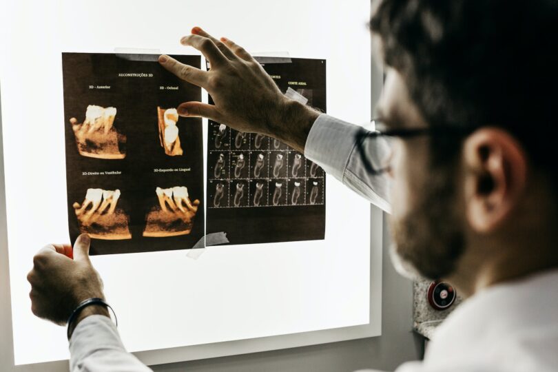 man looking at teeth x rays
