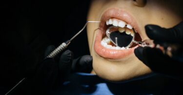 close up shot of a kid having dental checkup
