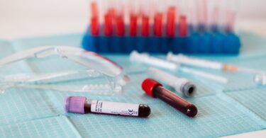 full vials of blood near various medical equipment for taking blood