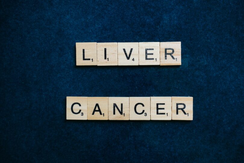 liver cancer text using scrabble tiles