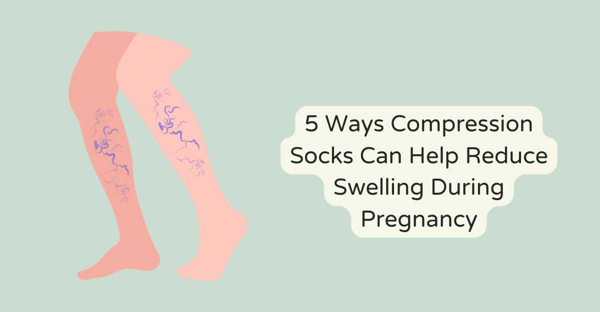 5 Ways Compression Socks Can Help Reduce Swelling During Pregnancy