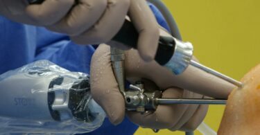 close up of arthroscopic knee surgery in progress